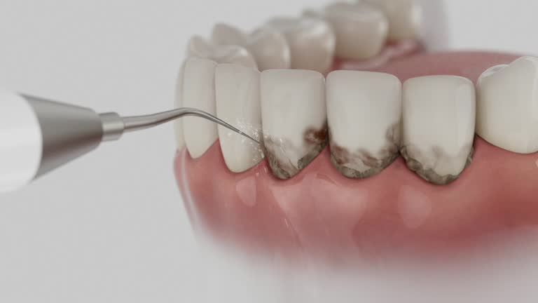 Reliable Dental contractor in Port Lavaca, TX by Smile Center Dentistry